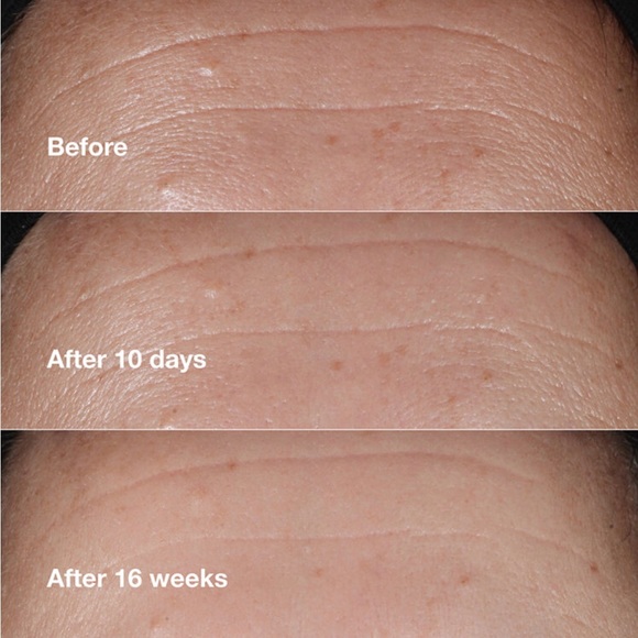 💜NIB💜 Clinique Smart Clinical Repair Wrinkle Correcting Serum BRAND NEW IN BOX - Picture 5 of 12